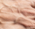 Skin as an immune hero: Fighting infections with self-made antibodies