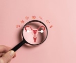 Global study reveals shifting trends in ovarian cancer incidence by subtype and region