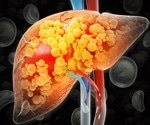 Revolutionizing MASLD treatment with GLP-1 receptor agonists