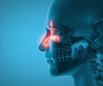 Nasal fungi differ in people with allergies and asthma