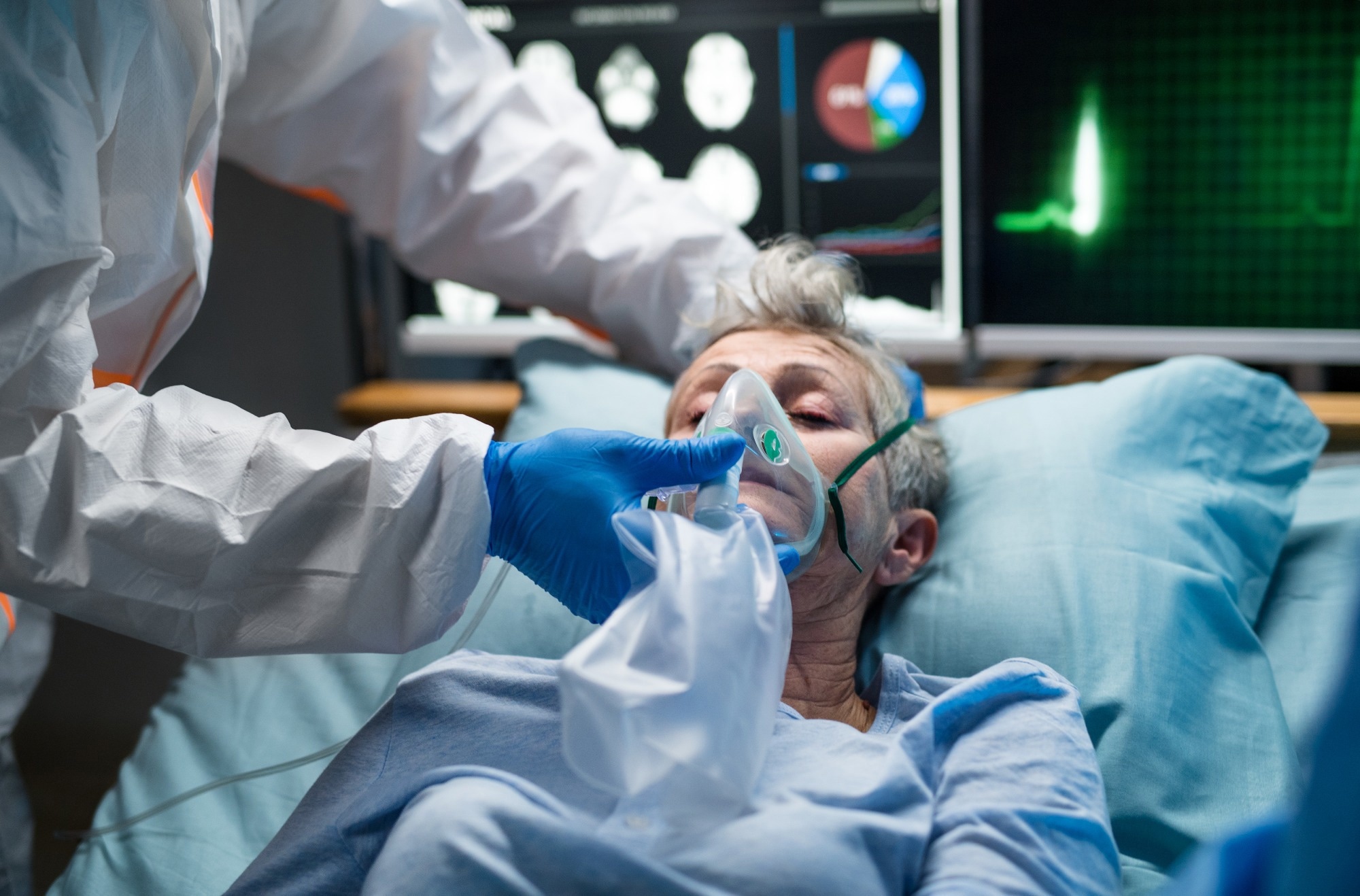 Study: The Silent Threat of Human Metapneumovirus: Clinical Challenges and Diagnostic Insights from a Severe Pneumonia Case. Image Credit: Ground Picture / Shutterstock