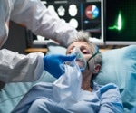 Hidden culprit: Human metapneumovirus identified in severe adult pneumonia case
