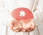 The X factor: Decoding brain aging differences between men and women