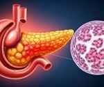 Pancreatic cancer insights: How pORG classifications predict survival and guide treatment