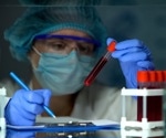 $2.5 Million Grant Awarded to Indiana University School of Medicine, Beckman Coulter Life Sciences to Expand Leukemia and Lymphoma Testing in Africa