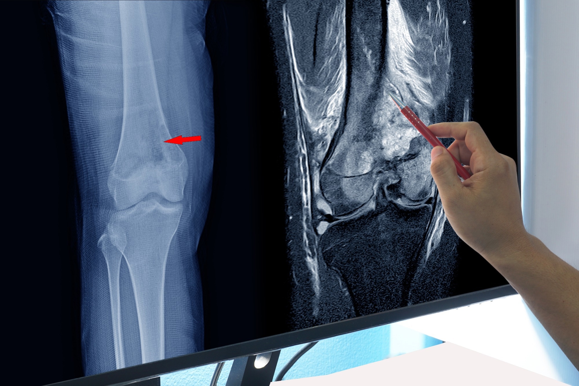Study: Association between life’s essential 8 and bone mineral density among adults aged 20–59 years. Image Credit: April stock / Shutterstock