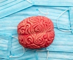 Does COVID increase the risk of Alzheimer’s disease?