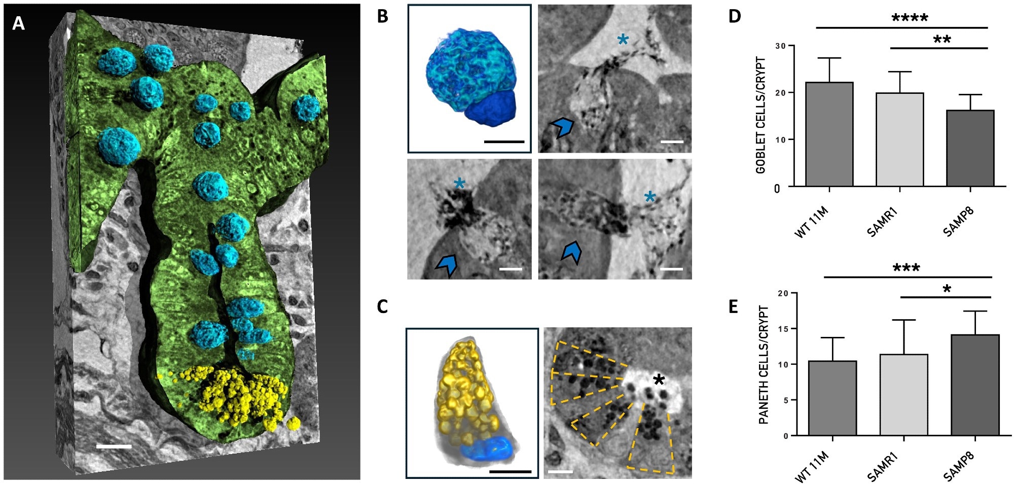 Nano-XPCT analysis of the Paneth and goblet cells. (A) Representative 3D rendering of the longitudinal view of one crypt of SAMR1 mouse. The epithelial layer of the crypt has been rendered in green. The Paneth cells are colored in yellow and the goblet cells in blue. Scale bars, 5 μm. (B) and (C) show 3D renderings and nano-XPCT close-ups of goblet and Paneth cells, respectively. The same color code of (A) has been used for the 3D renderings shown in (B) and (C). In detail, the goblet cell nucleus is colored in dark blue and the apical portion, expanded with mucin-secreting granules, which extends into the intestinal lumen, is rendered in light blue. The Paneth cell presents the typical pyramidal shape with basally situated nucleus (blue) and prominent apical granules (yellow) that occupy most of its cytoplasmatic region. Nano-XPCT close-ups in (B) show goblet cells (indicated by arrows) secreting mucus (asterisks) in the intestinal lumen. Scale bars, 2.5 μm. In (C), transversal view of a crypt in which the Paneth cells are arranged in a radial pattern (highlighted by the dashed-line boxes). The release of the antimicrobial granules (black dots, asterisk) into the lumen is visible. Scale bars, 5 μm. (D and E) Quantification of goblet and Paneth cells in the crypts. Results are obtained on 30 crypt per mouse (n = 1) and are shown as mean ± SD. One-way ANOVA P < 0.0001; post hoc by Tukey’s post hoc test: *P < 0.02, **P < 0.01, ***P < 0.001, and ****P < 0.0001.