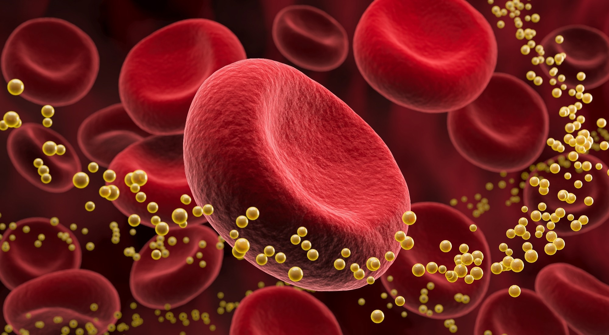 Study: Dietary Cholesterol and Myocardial Infarction in the Million Veteran Program. Image Credit: Anusorn Nakdee / Shutterstock