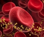 High cholesterol diets increase heart attack risk in U.S. veterans, study warns