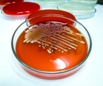 Light-activated therapy reduces antibiotic resistance in Staphylococcus aureus