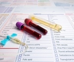 Novel biomarker for early prevention of Alzheimer’s disease
