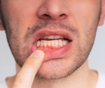 Vaping and gum health: How does it compare to smoking?