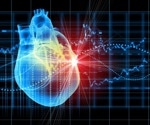 Sweat fails to match blood in tracking inflammation after heart attacks