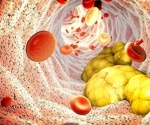 Higher 'bad' cholesterol levels may help Sardinia’s seniors live longer, study finds
