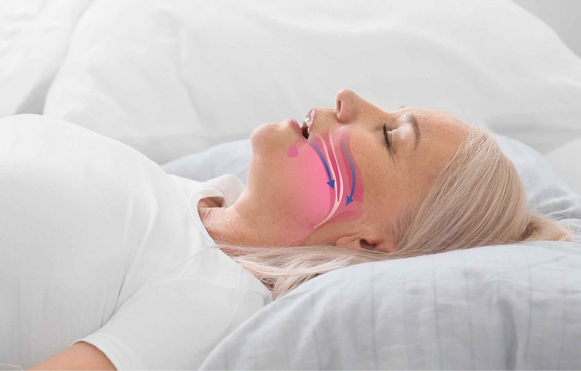 Study: Sleep Characteristics and Long-Term Risk of Type 2 Diabetes Among Women With Gestational Diabetes. Image Credit: Pixel-Shot / Shutterstock