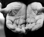 Scientists uncover rare gene variants that help people live past 100