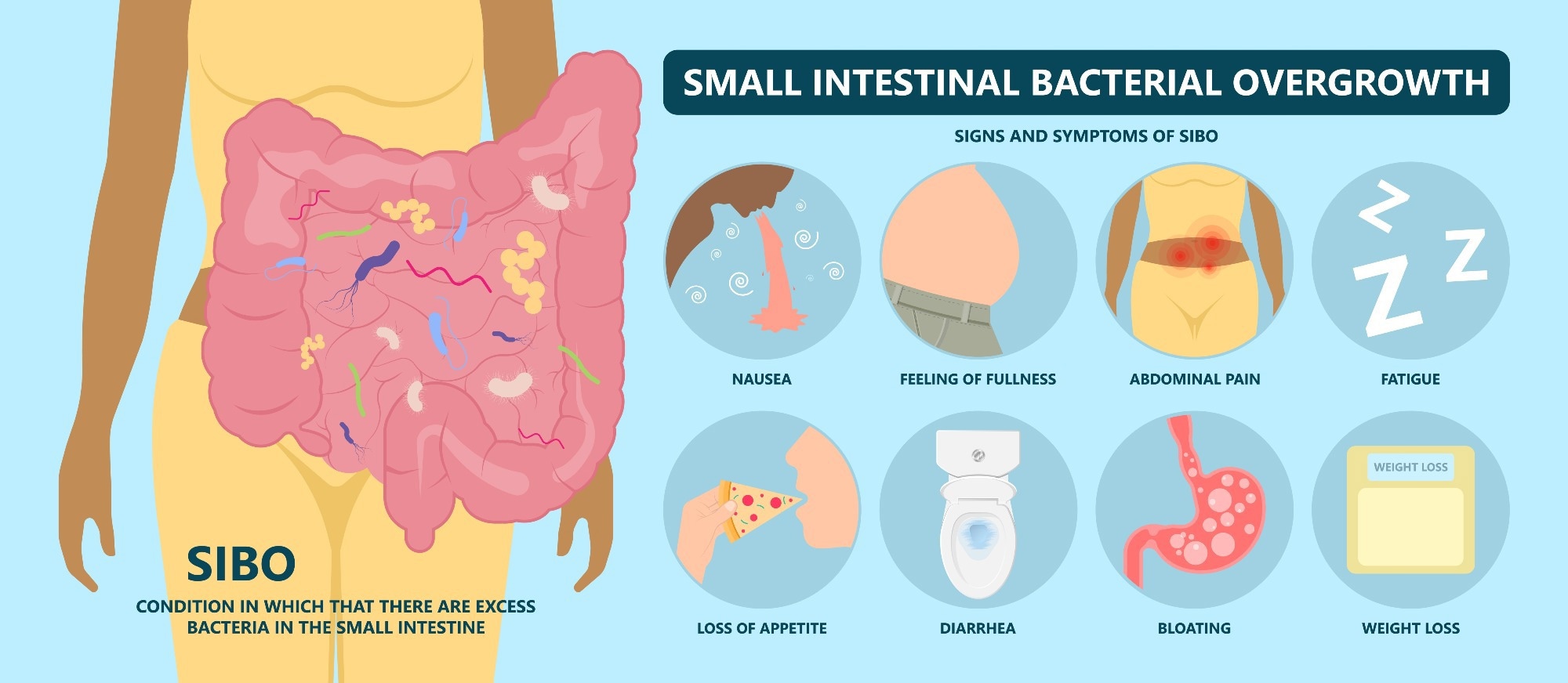 Study: Should We Treat SIBO Patients? Impact on Quality of Life and Response to Comprehensive Treatment: A Real-World Clinical Practice Study. Image Credit: Pepermpron / Shutterstock