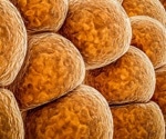 Your season of conception could shape your body’s calorie-burning ability