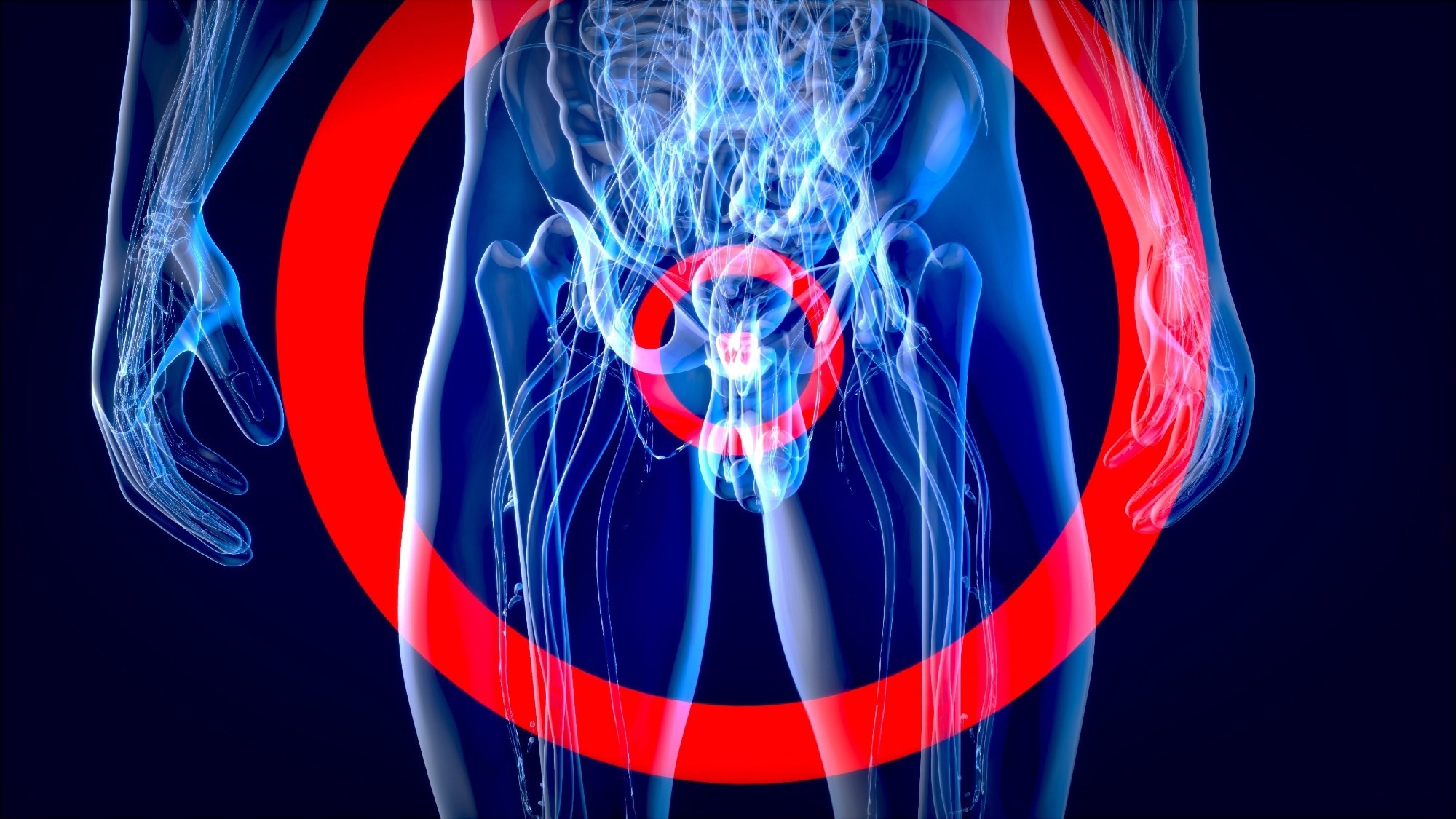 Study: Assessment of a Polygenic Risk Score in Screening for Prostate Cancer. Image Credit: Julien Tromeur / Shutterstock