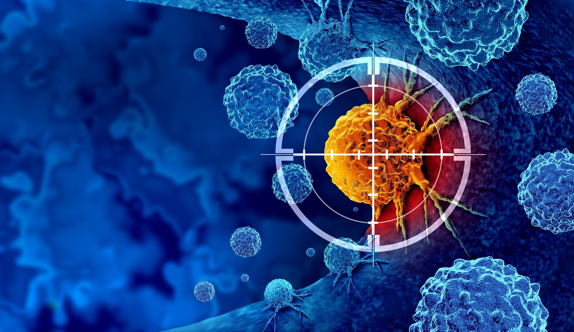 Study: Nonoperative Management of Mismatch Repair–Deficient Tumors. Image Credit: Lightspring / Shutterstock