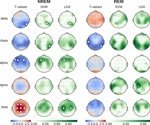 Caffeine increases brain complexity during sleep and shifts it toward a critical state