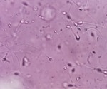 Low phosphate levels may help explain male infertility, study finds
