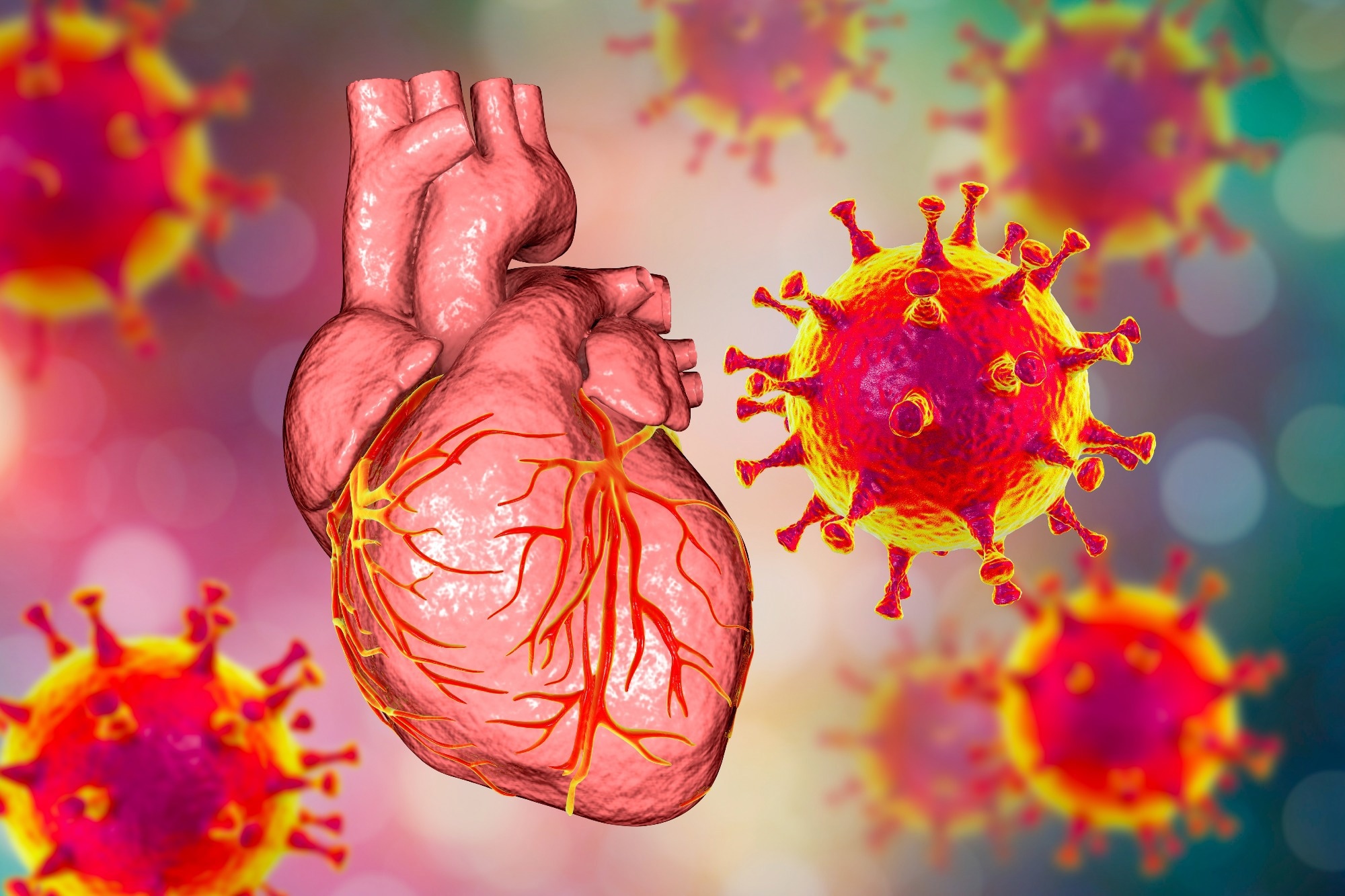 Study: Genome-wide association study of myocarditis and pericarditis following COVID-19 vaccination. Image Credit: Kateryna Kon / Shutterstock