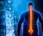 Lipid accumulation levels reveal hidden osteoporosis risk
