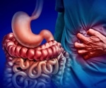 Can diet ease IBS? A low-FODMAP plan cut symptoms but raised nutrient concerns