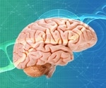 Longer breastfeeding boosts brain growth and thinking skills in teens, study shows