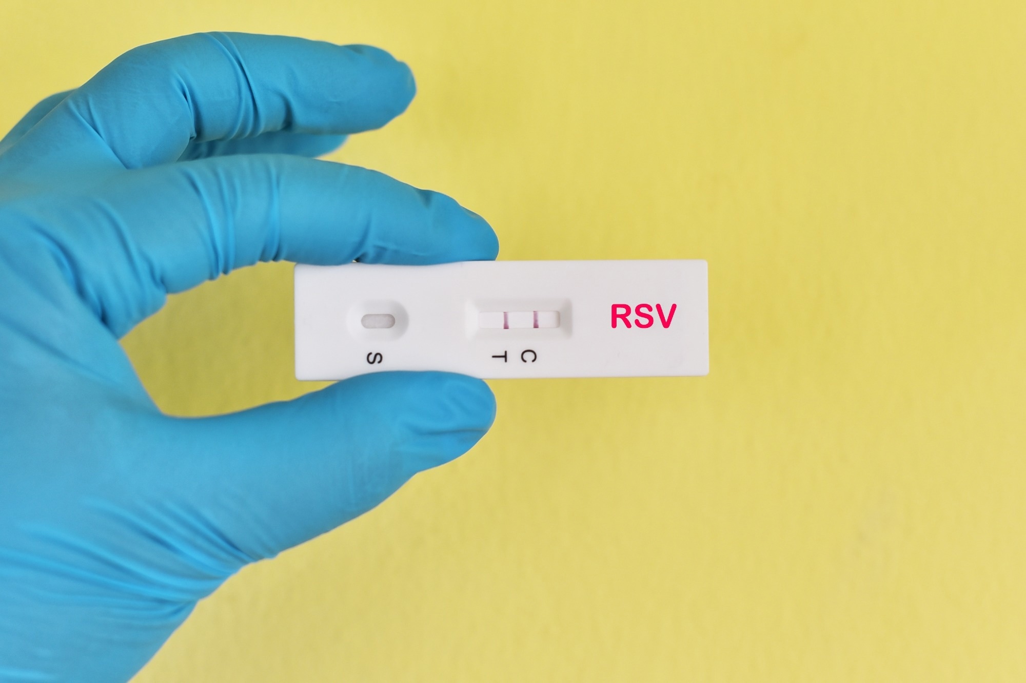 Study: Interim Evaluation of Respiratory Syncytial Virus Hospitalization Rates Among Infants and Young Children After Introduction of Respiratory Syncytial Virus Prevention Products — United States, October 2024–February 2025. Image Credit: Jarun Ontakrai / Shutterstock