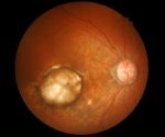 Oral 8-aminoguanine protects aging eyes and preserves vision in preclinical study