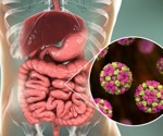 Norovirus GII.17 overtakes GII.4 as the dominant strain in US outbreaks