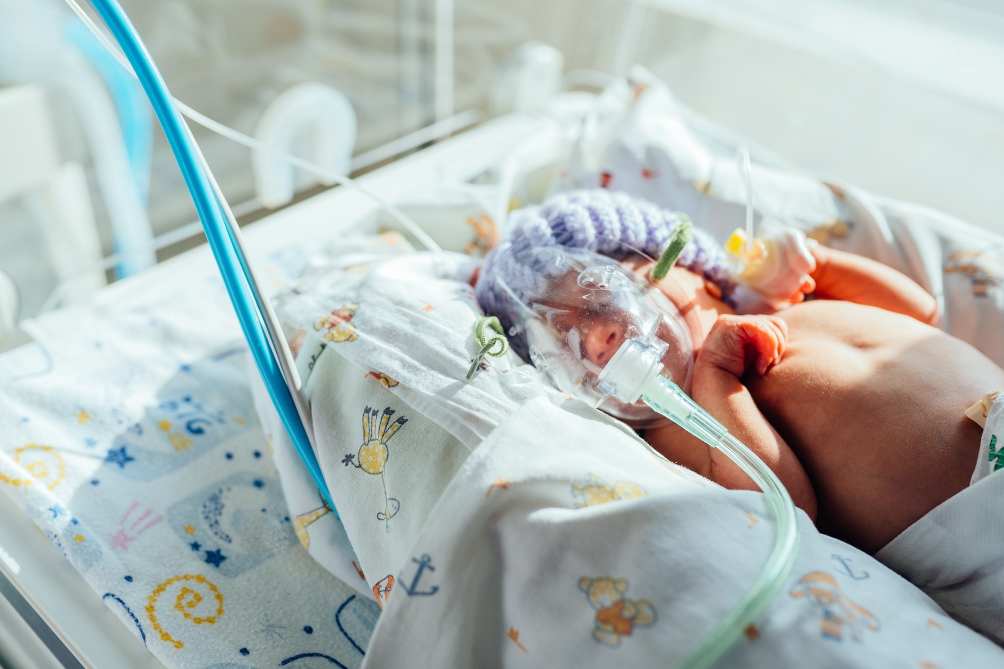 Small newborn child lies in pressure chamber connected to an artificial respiration apparatus
