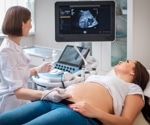 Genes may determine how early life exposures shape the gut microbiome