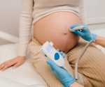 Use of sleep heart rate patterns to forecast diabetes risk in pregnancy