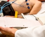 America slashes heart attack deaths but faces surge in deadly heart failure and arrhythmias