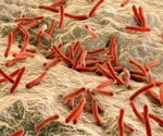 Scientists trace leprosy’s roots in South America back 4,000 years