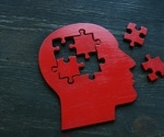 Redefining Alzheimer’s development by mapping disease sequences