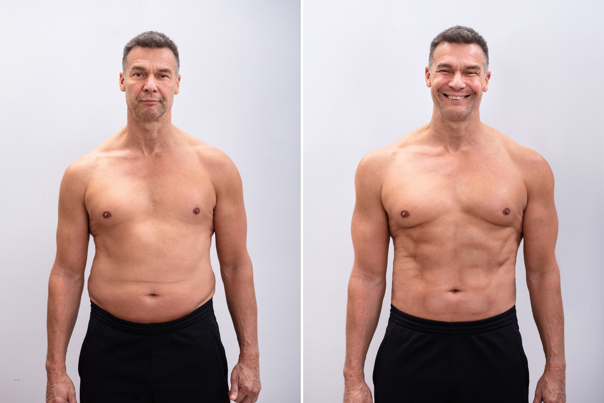 Study: Selective remodelling of the adipose niche in obesity and weight loss. Image Credit: Andrey_Popov / Shutterstock