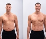 Weight loss wipes out senescent fat cells but leaves immune scars, study finds