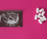 TMP-SMX in early pregnancy increases risk of birth defects, new study shows