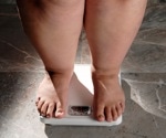 Why obesity spikes with wealth: The real culprit is on your plate