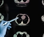 Study reveals pandemic life made brains age faster, even without catching COVID-19