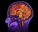 Perceived sickness activates real immune responses