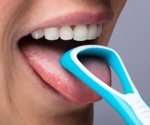 Using tongue coating to spot early signs of Parkinson’s disease