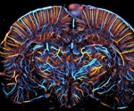 AXT brings Iconeus functional ultrasound to Australia and New Zealand, advancing brain research