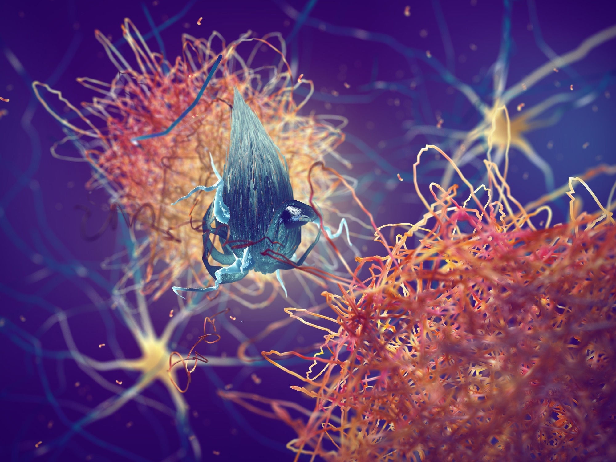 Study: Lithium deficiency and the onset of Alzheimer’s disease. Image Credit: nobeastsofierce / Shutterstock