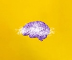 Fibromyalgia Diagnosis